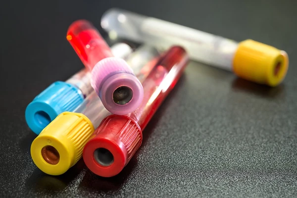Image for article titled Invitation for tuberculosis, hepatitis B and C, and HIV testing